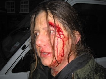 Current Chiddingfold huntsman, Adrian Thompson, pictured before a previous attack on hunt saboteurs